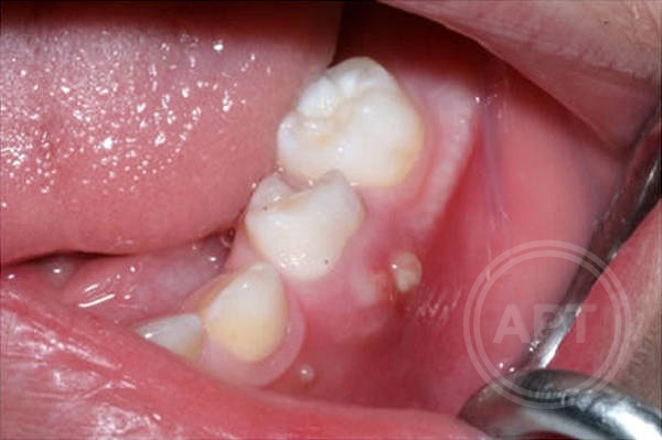Kra29at
